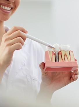 a dentist holding a model of a dental implant