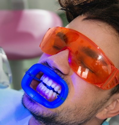 Dental patient getting his teeth professionally whitened