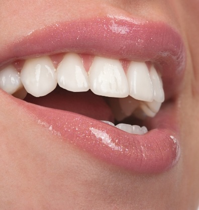 Close up of smile with flawless white teeth