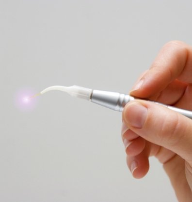 Hand holding a pen like dental laser device