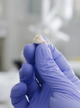 Dentist holding an extracted tooth in a gloved hand