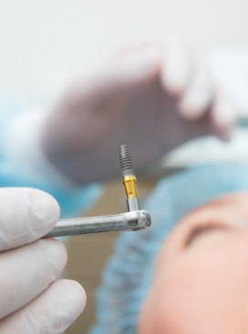 Dentist holding a dental implant before placing it in a patient