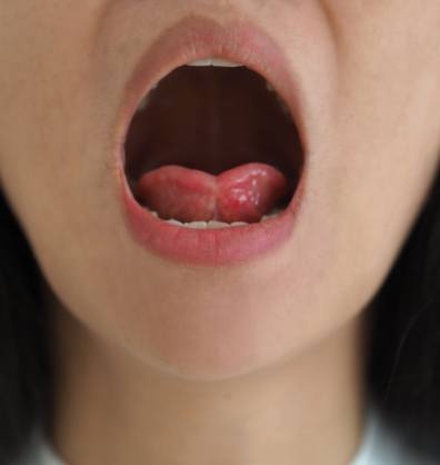 Close up of a person opening their mouth wide