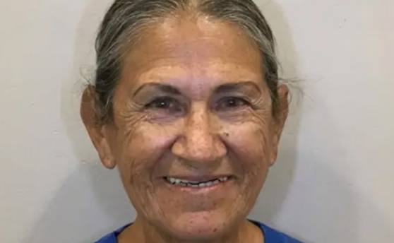 Senior woman smiling with worn teeth before All on 4 dental implants