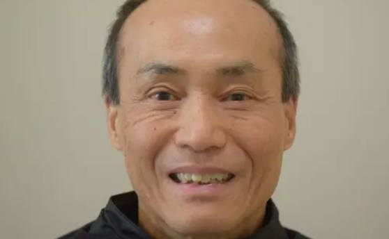 Man smiling with yellowed and crooked teeth