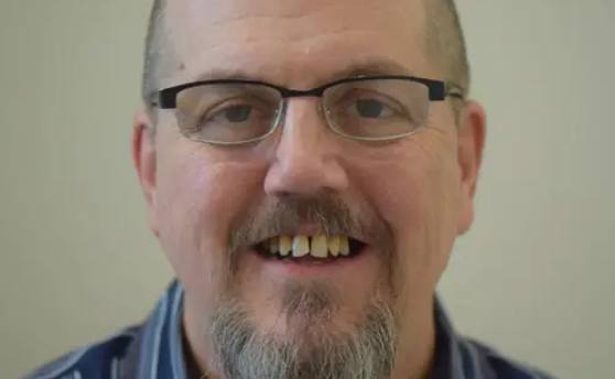 Man with gray goatee smiling with damaged and yellowed teeth