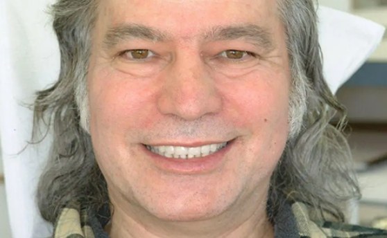 Man with long gray hair smiling with improved teeth after full mouth rehabilitation