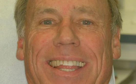 Senior man grinning with slightly misaligned teeth