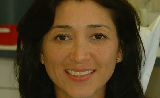 Woman with dark hair smiling with uneven and slightly damaged teeth